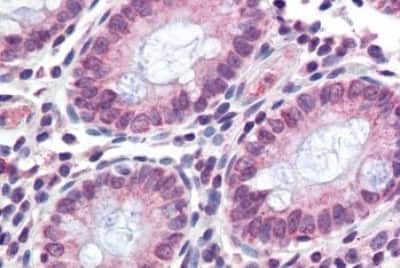 Immunohistochemistry-Paraffin: TMPRSS4 Antibody [NBP3-14501]